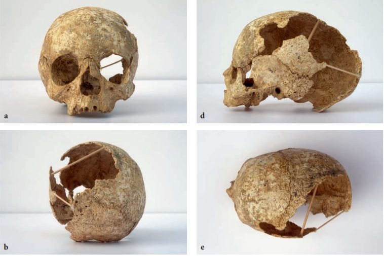 Les ossements humains du Mésolithique ancien de la grotte de Claminforge